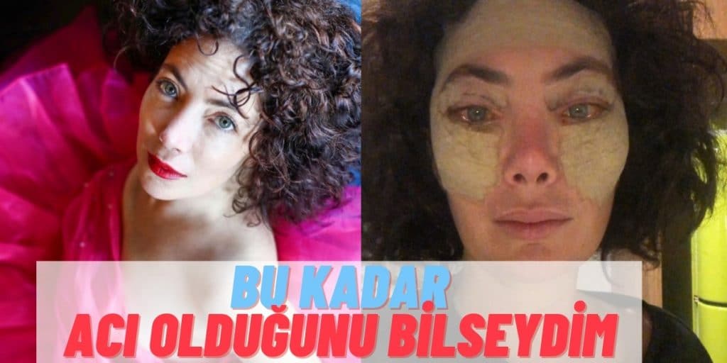 Akasya Asıltürkmen ‘Bella Eyes’ Operasyonu Yaptırdı: “Bu Kadar Acı Olduğunu Bilseydim…”