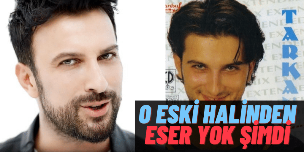 Tarkan 25 Yıl Öncesinden Bir TBT Yaptı! Değişimi Tüm Hayranları Şaşkına Döndürdü!