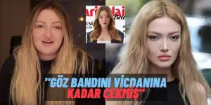 “Yüzüme baksalar anlamazlar” Demişti! Danla Bilic’in Badem Göz Ameliyatı Sosyal Medyada Alay Konusu Oldu