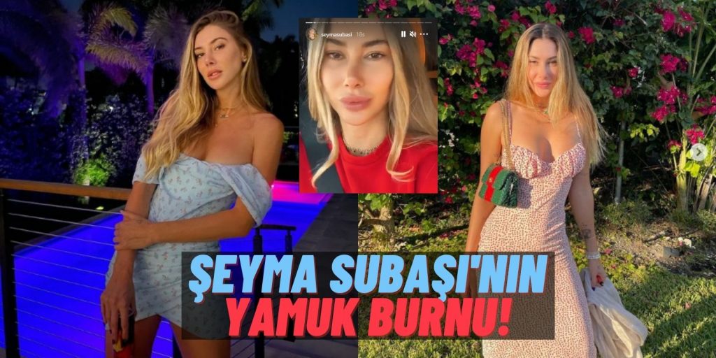 Şeyma Subaşı’nın 165 Bin Dolarlık “Yamuk” Burnu Görenleri Şoke Etti! Estetik Hatası mı, Instagram Filtresi mi?